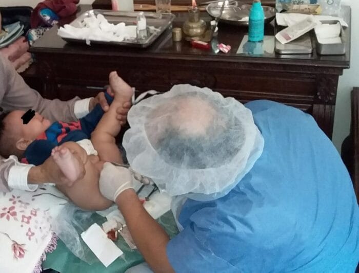 بشكل مجاني.. جماعة مولاي يعقوب تخصص ختان 50 مستفيد